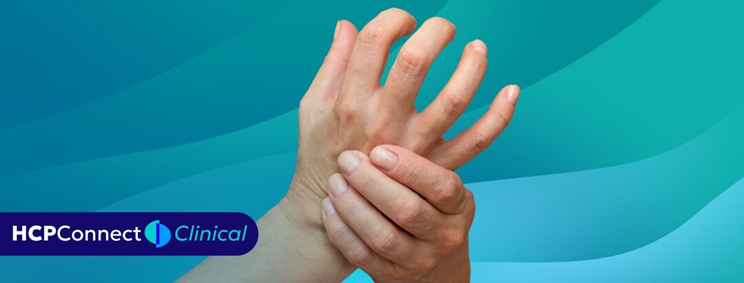 Extraglandular Manifestations Beyond Dryness image