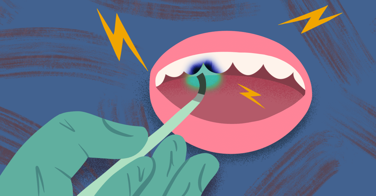 I Brush My Teeth Twice a Day. So Why Am I Losing Them? image